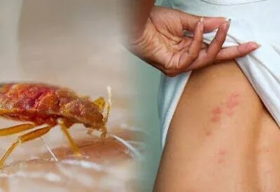 Dezinsectie - dezinfectie - deratizare - Bucuresti