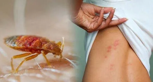 Dezinsectie - dezinfectie - deratizare - Bucuresti